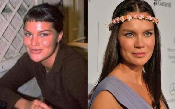 Ünlülerin Estetiksiz Halleri