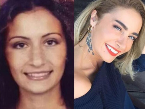 Ünlülerin Estetiksiz Halleri