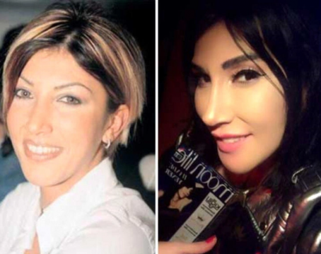 Ünlülerin Estetiksiz Halleri