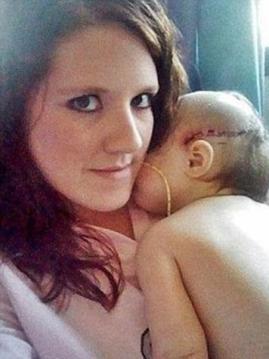 AĞLADIĞI İÇİN BABASI ONU BU HALE GETİRMİŞTİ! O BEBEK BÜYÜDÜ DÜNYA GÜZELİ