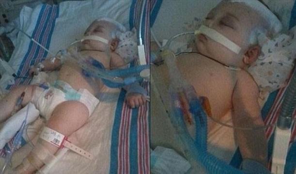 AĞLADIĞI İÇİN BABASI ONU BU HALE GETİRMİŞTİ! O BEBEK BÜYÜDÜ DÜNYA GÜZELİ