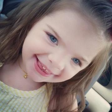 AĞLADIĞI İÇİN BABASI ONU BU HALE GETİRMİŞTİ! O BEBEK BÜYÜDÜ DÜNYA GÜZELİ