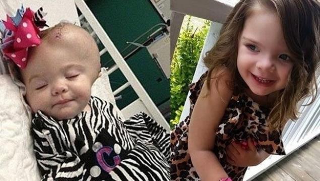 AĞLADIĞI İÇİN BABASI ONU BU HALE GETİRMİŞTİ! O BEBEK BÜYÜDÜ DÜNYA GÜZELİ