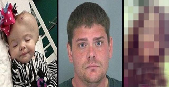 AĞLADIĞI İÇİN BABASI ONU BU HALE GETİRMİŞTİ! O BEBEK BÜYÜDÜ DÜNYA GÜZELİ