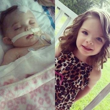 AĞLADIĞI İÇİN BABASI ONU BU HALE GETİRMİŞTİ! O BEBEK BÜYÜDÜ DÜNYA GÜZELİ