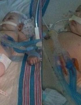 AĞLADIĞI İÇİN BABASI ONU BU HALE GETİRMİŞTİ! O BEBEK BÜYÜDÜ DÜNYA GÜZELİ