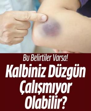 Bu Belirtiler Varsa Kalbiniz Düzgün Çalışmıyor Olabilir