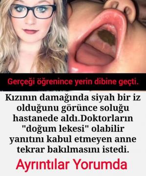 Bebeğin Ağzındakini Öğrenince Yerin Dibine Girdi..