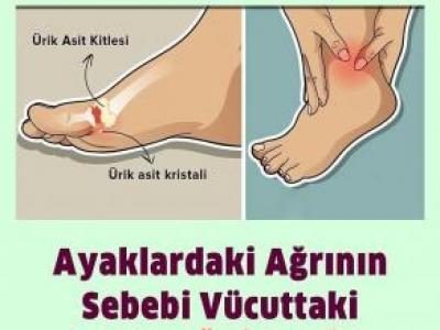 Ayaklardaki ağrının sebebi
