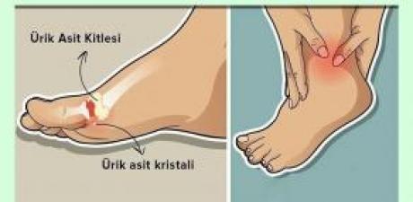 Ayaklardaki ağrının sebebi