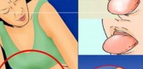 Kanserin Vücuda Verdiği Belirti