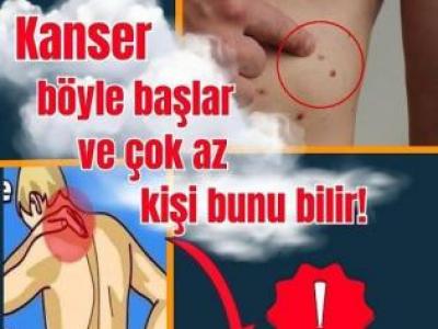 Kanserin Erken Belirtileri Neler