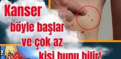 Kanserin Erken Belirtileri Neler