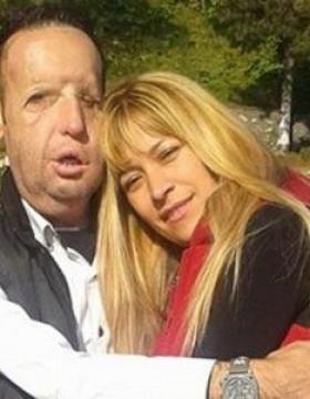 TÜRKİYE’DE İLK YÜZ NAKLİ OLAN RECEP SERT BABA OLDU! FAKAT BEBEĞİ ÇOK…