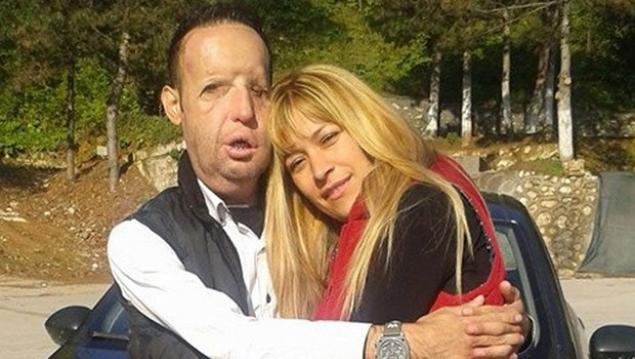 TÜRKİYE’DE İLK YÜZ NAKLİ OLAN RECEP SERT BABA OLDU! FAKAT BEBEĞİ ÇOK…