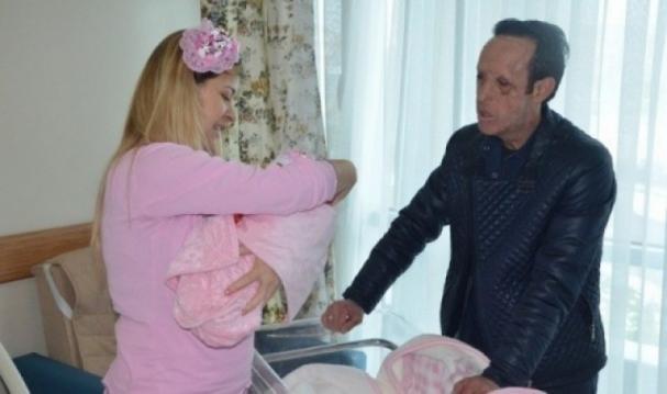 TÜRKİYE’DE İLK YÜZ NAKLİ OLAN RECEP SERT BABA OLDU! FAKAT BEBEĞİ ÇOK…