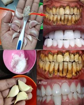 Diş Hekimlerinin bilmenizi istemediği sır