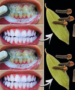 Diş Hekimlerinin bilmenizi istemediği sır