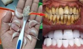 Diş Hekimlerinin bilmenizi istemediği sır