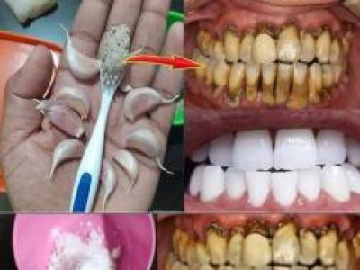 Diş Hekimlerinin bilmenizi istemediği sır