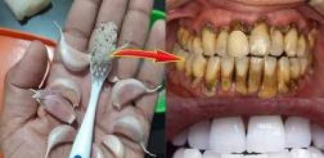 Diş Hekimlerinin bilmenizi istemediği sır