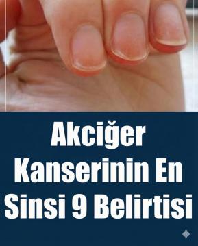 Akciğer Kanserinin En Sinsi 9 Bulgusu