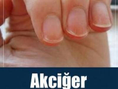 Akciğer Kanserinin En Sinsi 9 Bulgusu