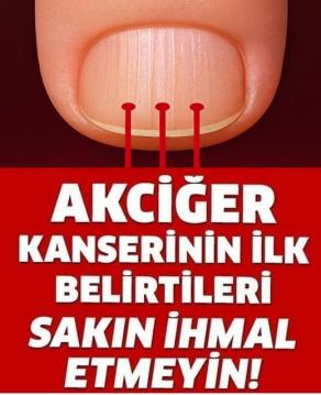 Son yıllarda artan vakalarla birlikte uzmanların sık sık uyarıyor