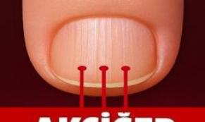 Son yıllarda artan vakalarla birlikte uzmanların sık sık uyarıyor