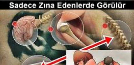 Zina Eden Birine Bu 3 Hastalığı Mutlaka verir.