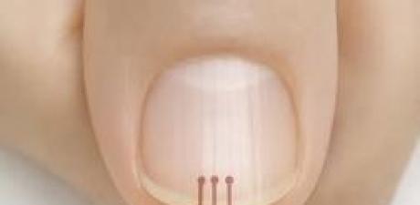 Tırnaklarınızdaki Dikey Çizgiler Size Ne Anlatıyor 