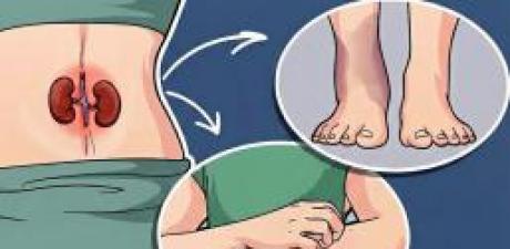 Böbrek Yetmezliğinin Erken Belirtisi! 