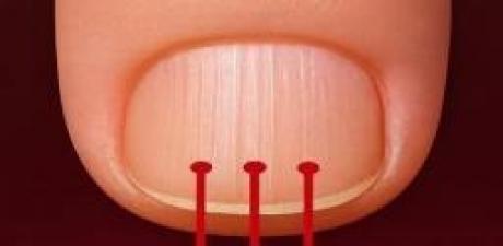 Akciğer Kanserinin En Sinsi 9 Belirtisi