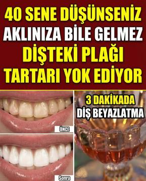 Diş Hekimlerinin bilmenizi istemediği