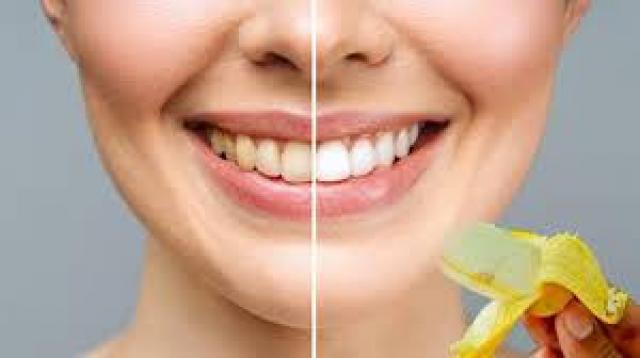 Diş Hekimlerinin bilmenizi istemediği