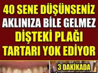 Diş Hekimlerinin bilmenizi istemediği