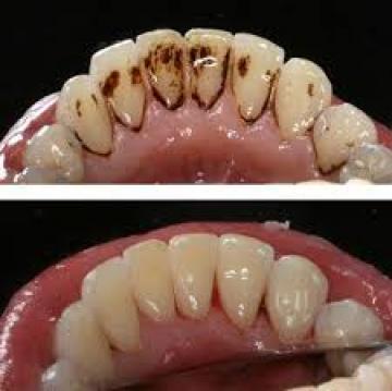 sadece birkaç dakika içinde