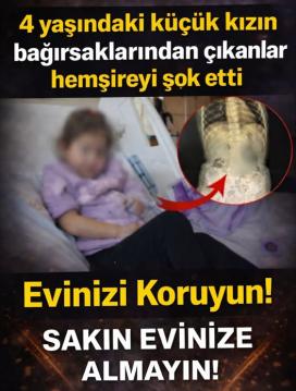 4 Yaşındaki Küçük Kızın bağırsağın dan çıkanlar