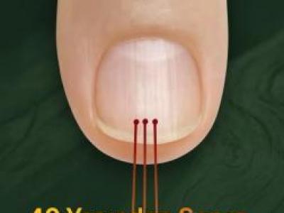 40 Yaşından Sonra Tırnağınızda Çizgiler Varsa