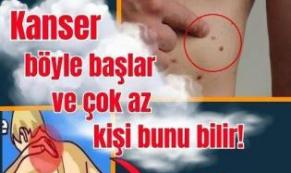 Kanserin Erken Belirtisi