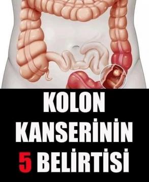 Kolon Kanserinin 5 Belirtisi
